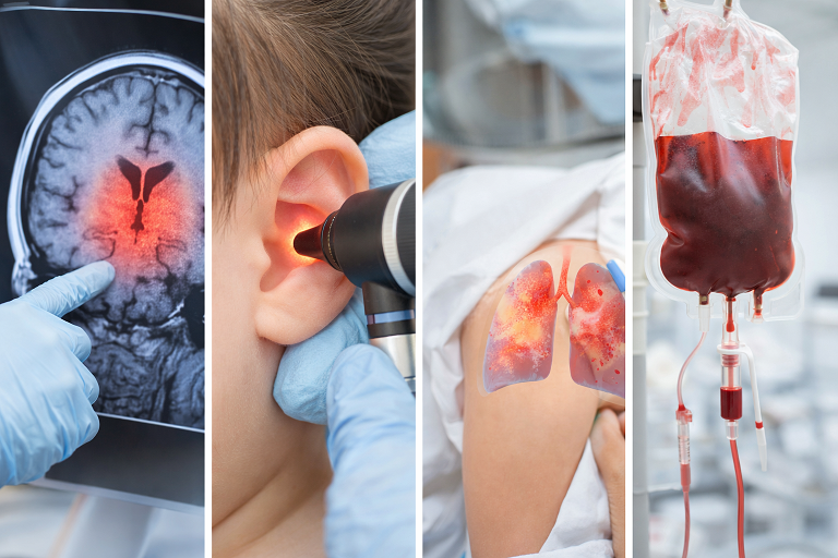 ข้อมูลประกอบการตัดสินใจวัคซีนเด็ก บรรยากาศดูแล