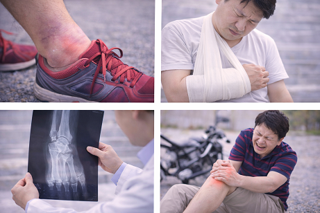 ผู้ป่วยบวมมาก เจ็บมาก หรือใช้งานแขนขาไม่ได้ เหมาะกับการเข้ารับการตรวจเอกซเรย์และรักษาแบบเร่งด่วน